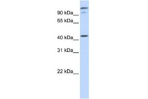 WB Suggested Anti-AFG3L2 Antibody Titration:  0. (AFG3L2 抗体  (Middle Region))