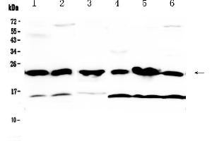 Western blot analysis of GST3 / GST pi using anti-GST3 / GST pi antibody . (GSTP1 抗体  (AA 2-210))