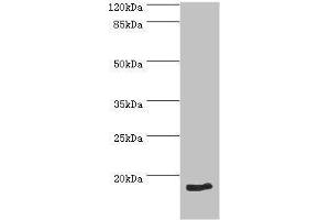 Western blot analysis of HeLa whole cell lysate, using NT-proBNP antibody (2 μg/ml). (NT-ProBNP 抗体  (AA 27-102))