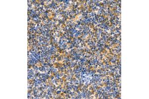 Immunohistochemistry of paraffin embedded rat lymph node using CD30 (ABIN7076073) at dilution of 1:600 (400x lens) (TNFRSF8 抗体)