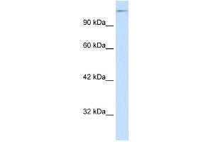 WB Suggested Anti-SUPT5H Antibody Titration: 0. (SUPT5H 抗体  (C-Term))