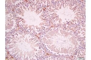Formalin-fixed and paraffin embedded rat testis tissue labeled with Anti-SOAT1 Polyclonal Antibody, Unconjugated 1:400 followed by conjugation to the secondary antibody and DAB staining. (SOAT1 抗体  (AA 51-150))