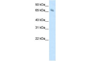 WB Suggested Anti-KBTBD10 Antibody Titration:  1. (Kelch-like protein 41 (KLHL41) (C-Term) 抗体)