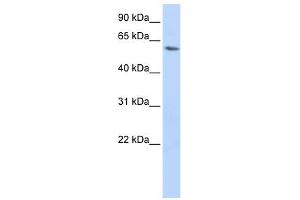 LSM14A antibody used at 1 ug/ml to detect target protein. (LSM14A 抗体)