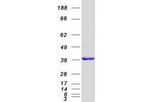 Western Blotting (WB) image for SUMO1 Activating Enzyme Subunit 1 (SAE1) (Transcript Variant 1) protein (Myc-DYKDDDDK Tag) (ABIN2731357)