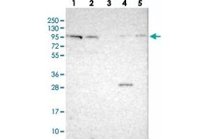 Western blot analysis of Lane 1: RT-4, Lane 2: U-251 MG, Lane 3: Human Plasma, Lane 4: Liver, Lane 5: Tonsil with CDH26 polyclonal antibody . (CDH26 抗体)