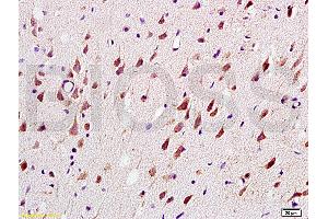 Formalin-fixed and paraffin embedded: rat brain tissue labeled with Anti-MAG-a/L-MAG Polyclonal Antibody (ABIN726935), Unconjugated at 1:200, followed by conjugation to the secondary antibody and DAB staining (MAG 抗体  (AA 551-626))