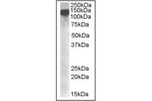 Image no. 1 for anti-ATP-Dependent RNA Helicase A (DHX9) (Internal Region) antibody (ABIN375159) (DHX9 抗体  (Internal Region))