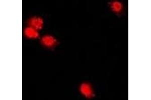Immunofluorescent analysis of CHRAC17 staining in U2OS cells. (POLE3 抗体)