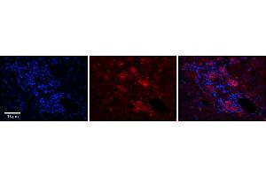 Rabbit Anti-C11orf24 Antibody      Formalin Fixed Paraffin Embedded Tissue: Human Adult Liver   Observed Staining: Membrane but only in connective tissue cells in the interlobular septum, very low tissue distribution  Primary Antibody Concentration: 1:100  Secondary Antibody: Donkey anti-Rabbit-Cy3  Secondary Antibody Concentration: 1:200  Magnification: 20X  Exposure Time: 0. (C11orf24 抗体  (N-Term))