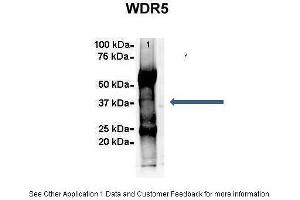 Amount and Sample Type :  500 ug Human NT2 cell lysate  Amount of IP Antibody :  6 ug  Primary Antibody :  WDR5  Primary Antibody Dilution :  1:500  Secondary Antibody :  Goat anti-rabbit Alexa-Fluor 594  Secondary Antibody Dilution :  1:5000  Gene Name :  WDR5  Submitted by :  Dr. (WDR5 抗体  (C-Term))