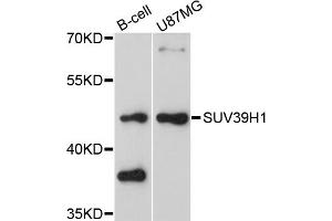 Western blot analysis of extracts of various cell lines, using SUV39H1 antibody. (SUV39H1 抗体)