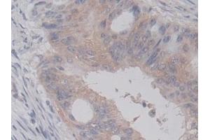 Immunohistochemistry (IHC) image for anti-Ras-related Protein Ral-A (rala) (AA 1-206) antibody (ABIN7428572)