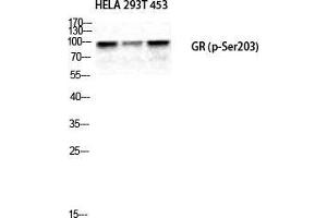Western Blot (WB) analysis of HeLa 293T 453 cells using Phospho-GR (S203) Polyclonal Antibody. (GR (pSer203) 抗体)