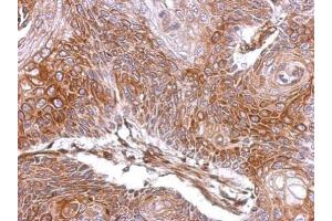 IHC-P Image Immunohistochemical analysis of paraffin-embedded Cal27 xenograft, using ELA3A, antibody at 1:500 dilution. (Elastase 3A 抗体)