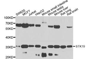 Western blot analysis of extracts of various cell lines, using STK19 antibody. (STK19 抗体)