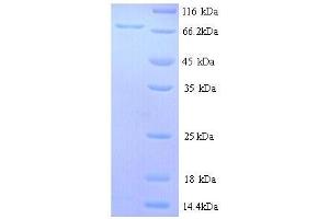 SDS-PAGE (SDS) image for Estrogen Receptor 1 (ESR1) (AA 10-595) protein (His tag) (ABIN7478954)
