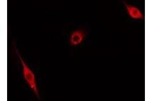 ABIN6276631 staining Hela cells by IF/ICC. (CDC20 抗体  (N-Term))