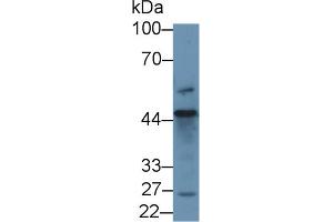 Western blot analysis of Human 293T cell lysate, using Human D2HGDH Antibody (1 µg/ml) and HRP-conjugated Goat Anti-Rabbit antibody ( (D2HGDH 抗体  (AA 56-232))