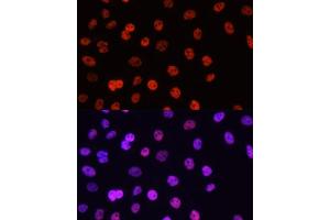Immunofluorescence analysis of HeLa cells using Asymmetric DiMethyl-Histone H3-R17 antibody (ABIN3023282, ABIN3023283, ABIN3023284 and ABIN6219538) at dilution of 1:100. (Histone 3 抗体  (H3R17me))