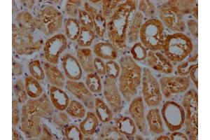 IHC image of ABIN7127521 diluted at 1:100 and staining in paraffin-embedded human kidney tissue performed on a Leica BondTM system. (Recombinant GPX4 抗体)