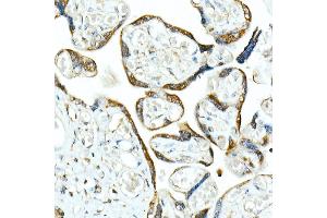 Immunohistochemistry of paraffin-embedded human placenta using Smad9 Rabbit pAb (ABIN6132668, ABIN6148096, ABIN6148097 and ABIN6223425) at dilution of 1:100 (40x lens). (SMAD9 抗体  (AA 1-300))