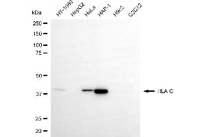 Western blotting analysis using HLA-C antibody (ABIN7799321).