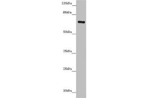 Western blot All lanes: ZNF169 antibody at 5. (ZNF169 抗体  (AA 1-85))