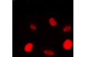 Immunofluorescent analysis of RAD54A staining in HEK293T cells. (RAD54L 抗体)