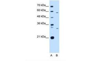 Image no. 2 for anti-CD36 (CD36) (N-Term) antibody (ABIN6738418) (CD36 抗体  (N-Term))