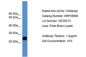 WB Suggested Anti-UCHL1  Antibody Titration: 0.