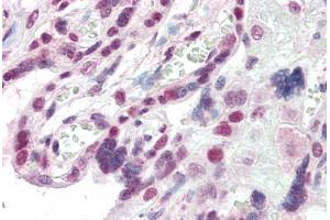 Human Placenta (formalin-fixed, paraffin-embedded) stained with CBX1 antibody ABIN337122 at 2. (CBX1 抗体  (AA 69-81))