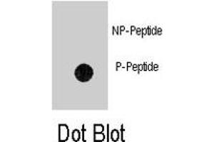 Dot blot analysis of ANTXR1 (phospho Y382) polyclonal antibody  on nitrocellulose membrane. (ANTXR1 抗体  (pTyr382))
