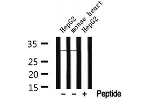 Western blot analysis of extracts from HepG2 and mouse heart, using CYB5R2 Antibody. (CYB5R2 抗体  (Internal Region))