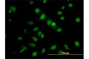 Immunofluorescence of purified MaxPab antibody to RBMS1 on HeLa cell. (RBMS1 抗体  (AA 1-406))