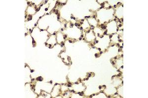 Immunohistochemistry (IHC) image for anti-DNA Repair Protein Complementing XP-B Cells (ERCC3) (AA 513-782) antibody (ABIN3022427) (ERCC3 抗体  (AA 513-782))