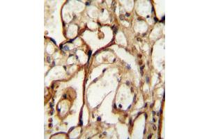 Immunohistochemistry (IHC) image for anti-Solute Carrier Family 3 (Activators of Dibasic and Neutral Amino Acid Transport), Member 2 (SLC3A2) antibody (ABIN2995541) (SLC3A2 抗体)