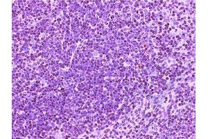 Immunohistochemistry (IHC) image for anti-CD4 (CD4) (AA 385-457) antibody (ABIN671376)