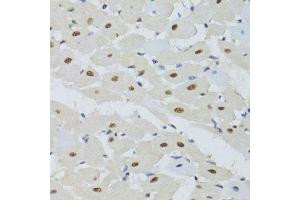 Immunohistochemistry of paraffin-embedded mouse heart using DDB1 Antibody. (DDB1 抗体)