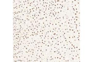 Immunohistochemistry of paraffin embedded rat adrenal gland using RBM8A (ABIN7075478) at dilution of 1: 300 (300x lens)