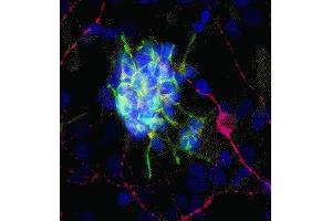 Immunofluorescence of cultured rat neurons showing strong cytoplasmic staining of doublecortin (green) in developing neurons and GFAP ( ABIN361379) in red. (Doublecortin 抗体)