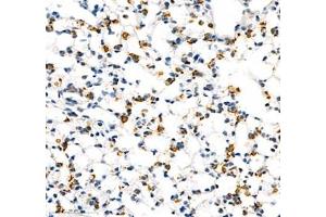 Immunohistochemistry of paraffin embedded mouse lung using AMIGO2 (ABIN7072966) at dilution of 1: 1300 (400x lens)