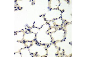 Immunohistochemistry of paraffin-embedded rat lung using PNKP antibody at dilution of 1:100 (x40 lens). (PNKP 抗体)
