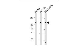 All lanes : Anti-TI Antibody (C-term) at 1:2000 dilution Lane 1: Ramos whole cell lysate Lane 2: HC whole cell lysate Lane 3: RI 8226 whole cell lysate Lysates/proteins at 20 μg per lane. (TIAM1 抗体  (C-Term))
