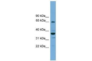 Western Blot showing TH1L antibody used at a concentration of 1-2 ug/ml to detect its target protein. (TH1-Like 抗体  (N-Term))