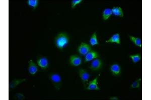 Immunofluorescence staining of A549 cells with ABIN7154549 at 1:44, counter-stained with DAPI. (GDF5 抗体  (AA 202-501))
