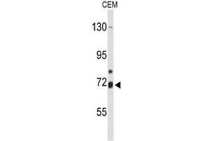 Western blot analysis of ALOX15B Antibody (C-term) in CEM cell line lysates (35µg/lane). (ALOX15B 抗体  (C-Term))