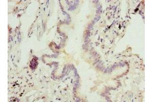 Immunohistochemistry of paraffin-embedded human lung tissue using ABIN7143016 at dilution of 1:100 (CHIA 抗体  (AA 1-368))