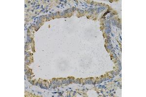 Immunohistochemistry of paraffin-embedded mouse lung using NEK2 Antibody (ABIN5973091) at dilution of 1/100 (40x lens). (NEK2 抗体)