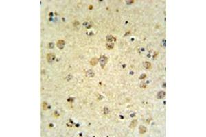 Immunohistochemistry analysis in formalin fixed and paraffin embedded brain tissue reacted with MAP4K3 Antibody , which was peroxidase conjugated to the secondary antibody and followed by DAB staining. (MAP4K3 抗体)